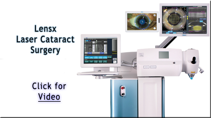 Video on Laser Assisted Cataract Surgery